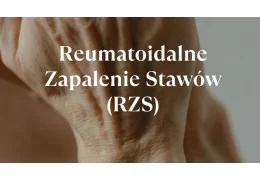 Reumatoidalne Zapalenie Stawów (RZS) objawy i suplementacja